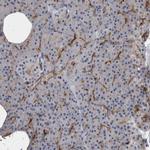 CD59 Antibody in Immunohistochemistry (Paraffin) (IHC (P))