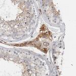 CD59 Antibody in Immunohistochemistry (Paraffin) (IHC (P))