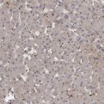 MST3 Antibody in Immunohistochemistry (Paraffin) (IHC (P))