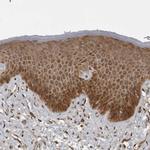 MST3 Antibody in Immunohistochemistry (Paraffin) (IHC (P))