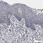 ACADM Antibody in Immunohistochemistry (Paraffin) (IHC (P))