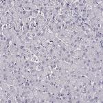 AIPL1 Antibody in Immunohistochemistry (Paraffin) (IHC (P))