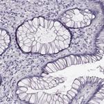 AIPL1 Antibody in Immunohistochemistry (Paraffin) (IHC (P))