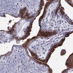 ERO1L Antibody in Immunohistochemistry (Paraffin) (IHC (P))