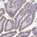 ERO1L Antibody in Immunohistochemistry (Paraffin) (IHC (P))