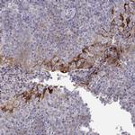 ERO1L Antibody in Immunohistochemistry (Paraffin) (IHC (P))