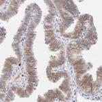 EpCAM Antibody in Immunohistochemistry (Paraffin) (IHC (P))