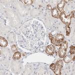 EpCAM Antibody in Immunohistochemistry (Paraffin) (IHC (P))