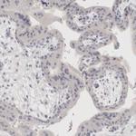 EpCAM Antibody in Immunohistochemistry (Paraffin) (IHC (P))