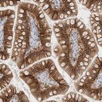 EpCAM Antibody in Immunohistochemistry (Paraffin) (IHC (P))