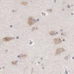 Ribophorin I Antibody in Immunohistochemistry (Paraffin) (IHC (P))