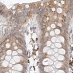 Ribophorin I Antibody in Immunohistochemistry (Paraffin) (IHC (P))