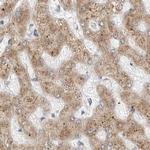 Ribophorin I Antibody in Immunohistochemistry (Paraffin) (IHC (P))