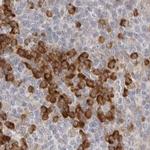 Ribophorin I Antibody in Immunohistochemistry (Paraffin) (IHC (P))