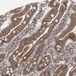 Nectin 1 Antibody in Immunohistochemistry (Paraffin) (IHC (P))