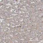 Nectin 1 Antibody in Immunohistochemistry (Paraffin) (IHC (P))