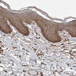 Nectin 1 Antibody in Immunohistochemistry (Paraffin) (IHC (P))