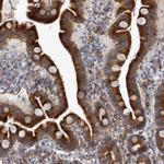 MINPP1 Antibody in Immunohistochemistry (Paraffin) (IHC (P))