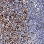 FCER1G Antibody in Immunohistochemistry (Paraffin) (IHC (P))