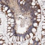 GANAB Antibody in Immunohistochemistry (Paraffin) (IHC (P))