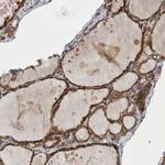 GANAB Antibody in Immunohistochemistry (Paraffin) (IHC (P))