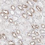 Kir1.1 (KCNJ1) Antibody in Immunohistochemistry (Paraffin) (IHC (P))