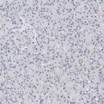 Kir1.1 (KCNJ1) Antibody in Immunohistochemistry (Paraffin) (IHC (P))