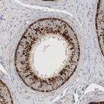 LYAG Antibody in Immunohistochemistry (Paraffin) (IHC (P))