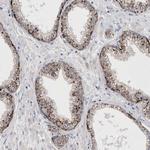 LYAG Antibody in Immunohistochemistry (Paraffin) (IHC (P))