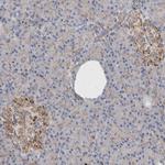 LYAG Antibody in Immunohistochemistry (Paraffin) (IHC (P))