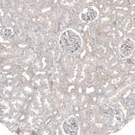 Fibronectin Antibody in Immunohistochemistry (Paraffin) (IHC (P))