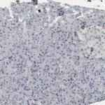 Fibronectin Antibody in Immunohistochemistry (Paraffin) (IHC (P))