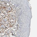 Fibronectin Antibody in Immunohistochemistry (Paraffin) (IHC (P))