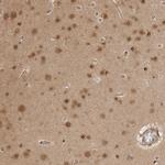 NUDC Antibody in Immunohistochemistry (Paraffin) (IHC (P))