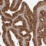 NUDC Antibody in Immunohistochemistry (Paraffin) (IHC (P))