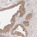 NUDC Antibody in Immunohistochemistry (Paraffin) (IHC (P))