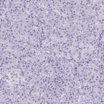 ECM1 Antibody in Immunohistochemistry (Paraffin) (IHC (P))