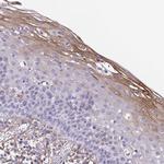 ECM1 Antibody in Immunohistochemistry (Paraffin) (IHC (P))