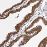 WDR77 Antibody in Immunohistochemistry (Paraffin) (IHC (P))