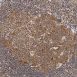 WDR77 Antibody in Immunohistochemistry (Paraffin) (IHC (P))