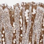 WDR77 Antibody in Immunohistochemistry (Paraffin) (IHC (P))