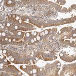 TCP1 Antibody in Immunohistochemistry (Paraffin) (IHC (P))