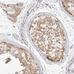 TCP1 Antibody in Immunohistochemistry (Paraffin) (IHC (P))