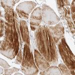 MEK5 Antibody in Immunohistochemistry (Paraffin) (IHC (P))