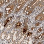 HTRA2 Antibody in Immunohistochemistry (Paraffin) (IHC (P))