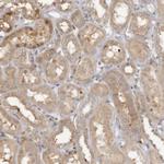 HTRA2 Antibody in Immunohistochemistry (Paraffin) (IHC (P))