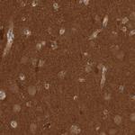 OXR1 Antibody in Immunohistochemistry (Paraffin) (IHC (P))