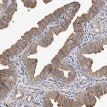 OXR1 Antibody in Immunohistochemistry (Paraffin) (IHC (P))