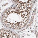 OXR1 Antibody in Immunohistochemistry (Paraffin) (IHC (P))