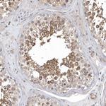 OXR1 Antibody in Immunohistochemistry (Paraffin) (IHC (P))